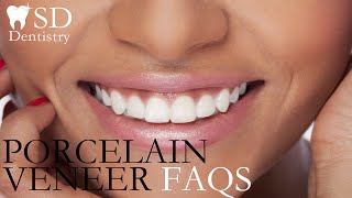 PORCELAIN VENEERS | 5 FAQS