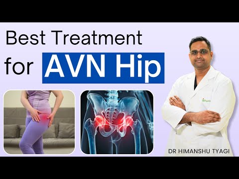 Best Treatment for AVN Hip | Avascular Necrosis Stages & Hip Replacement Explained