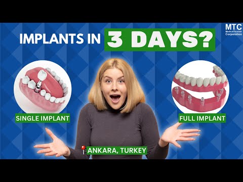 Dental Implants in Turkey: All You Need To Know in Under 3 Minutes!