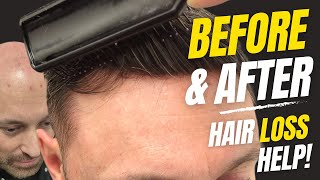 Before & After | Hair System | Hair Loss To Full Hair In Minutes | Hair Replacement System Men UK
