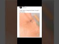 funny mosquito can't penetrate