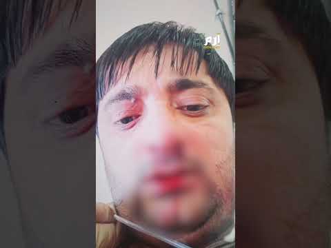 حلبة مصارعة داخل المستشفى.. طبيب ومريض يتبادلان اللكمات 