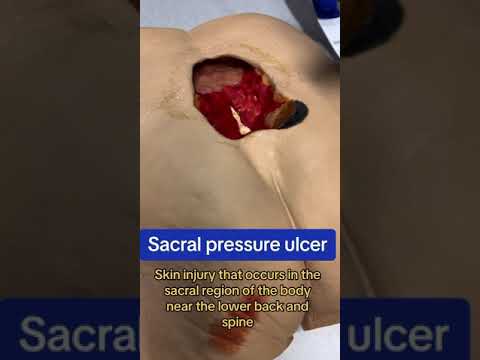 HOW TO MEASURE WOUNDS