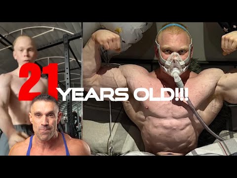 21 Year Old Steroid CPAP Freak