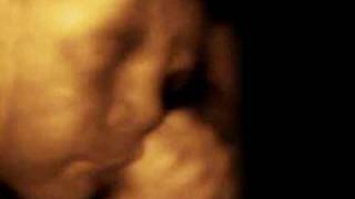 Development Week 30 Video