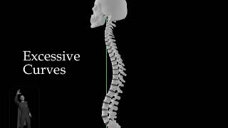 Excessive Curves - Skull and Spine