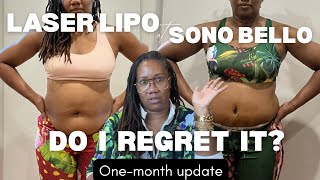 I'm 49 and I Had a Tummy Tuck at Sono Bello: See My Before & After [Part One]