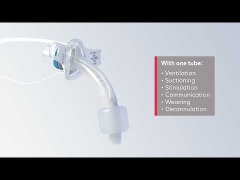 Tracoe Twist Plus Extract Tracheostomy Tubes: From Insertion to Decannulation Process