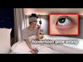 Got a Nasty Eye Infection during Romantic Honey Moon