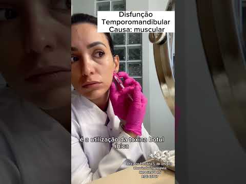 BOTOX para Disfunção temporomandibular- COE- #otorrinolaringologia