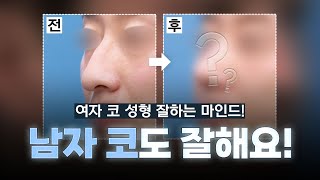 딱 보면 각 나오는 남자 코성형! (ft. 마인드성형외과 - 이영택 원장님)