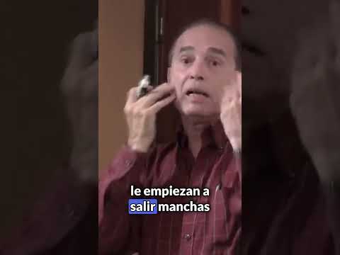 Manchas en la cara y las manos.