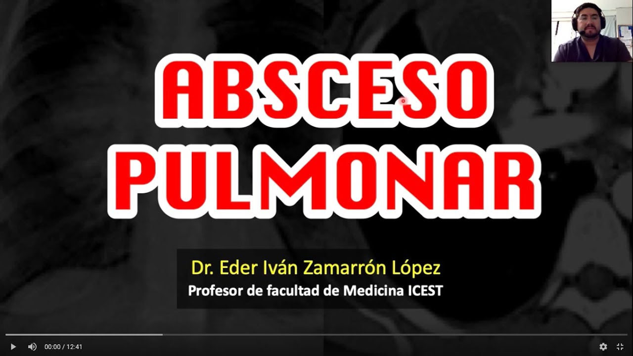 Absceso Pulmonar un “Vistazo rápido”