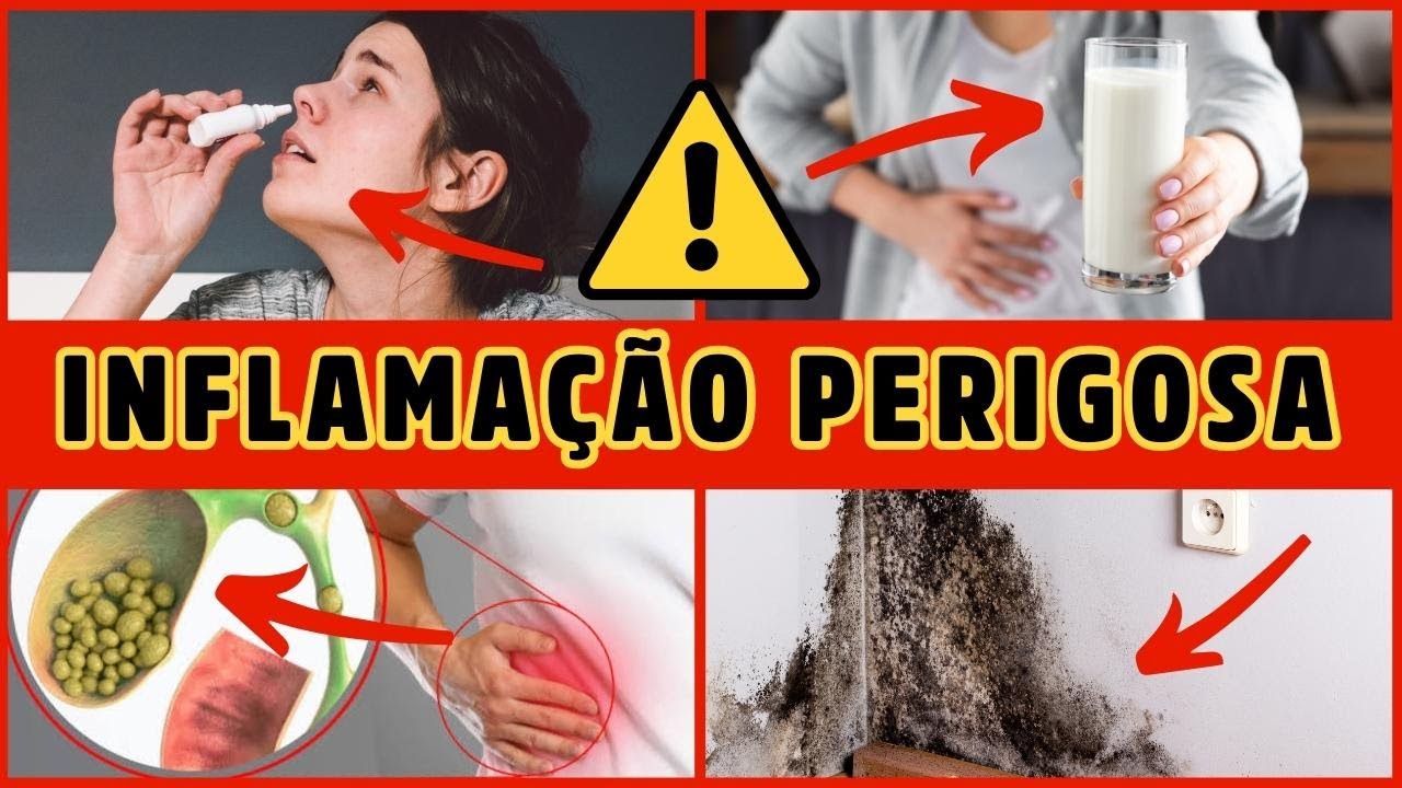 12 CAUSAS COMUNS DE INFLAMAÇÃO CRÔNICA SILENCIOSA - Dr Alain Dutra [ saúde e medicina]