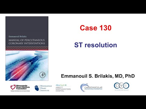 Case 130:  PCI Manual - ST elevation resolution