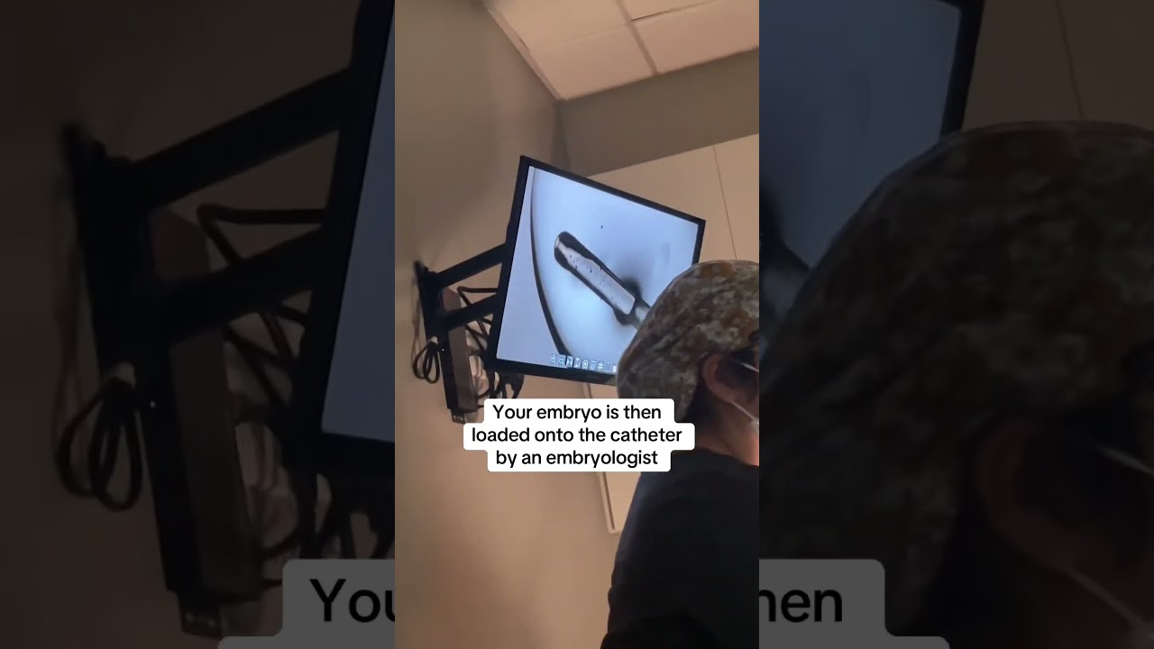 Do an embryo transfer with us for our IVF patient! ✨🤍 #ivf #embryotransfer #fertility #infertility