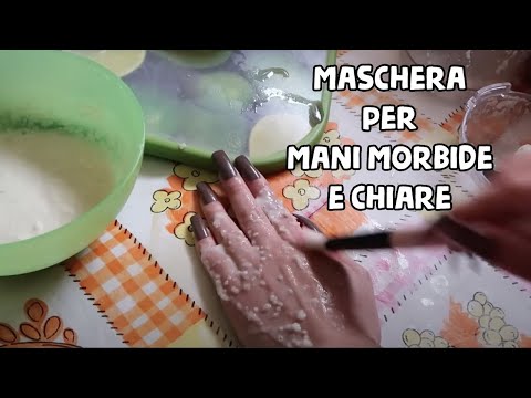 Decolorazione della persona in linea I pigmentary notano al bimbo
