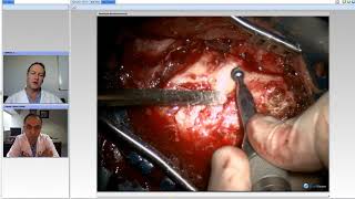 Download Lagu The Grand Rounds I: Conquering Technical Challanges in Tumor Surgery (Preview) Thumbnail