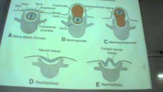 Dr.Sherif Fahmy - Embryology 21 - Development of Vertebral Column & Limbs& Skin