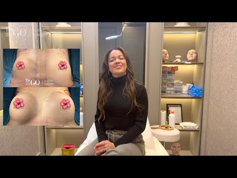 Achieving Natural Balance: 345cc Breast Implant Journey