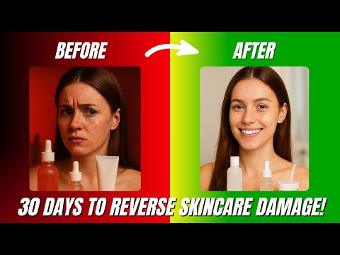How I Finally Found What Works! Simple Tips To Get Clear Skin