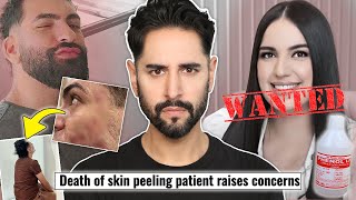 Influencer Face Peel Turns Deadly - The Dangers of Unregulated Treatments - When Beauty Turns Ugly