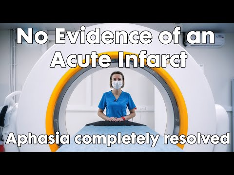 Stroke stories video thumbnail