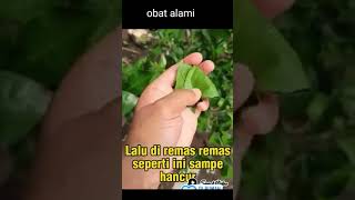 Download lagu Obat Alami Sakit Gigi #resepdokter #sakit #sakitgigi mp3 Download lagu Obat Alami Sakit Gigi #resepdokter #sakit #sakitgigi mp3