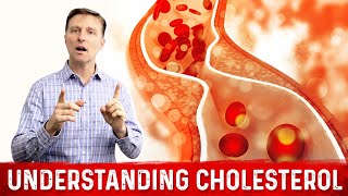 How to Read and Understand Your Cholesterol Levels – Dr.Berg
