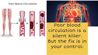 Poor blood circulation is a silent killer but you can fix it | Move. Breathe. Eat smart. Hydrate.|