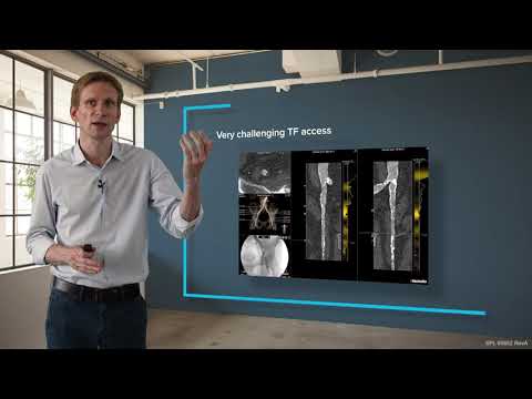 IVL in practice, patient selection and cases: IVL Pre TAVI Tutorial Chapter 5 with Dr. Ole de Backer