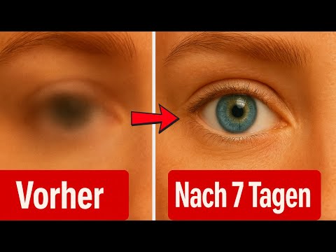 Take these vitamins for better eyes (It works wonders in just 7 days) 🤯