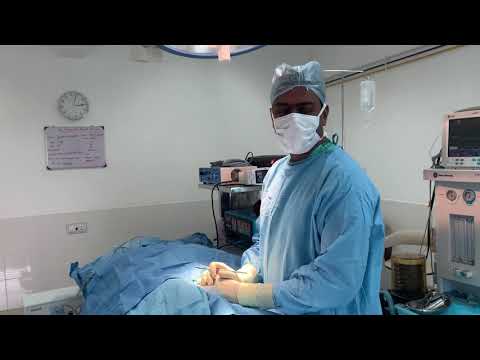Costal Rib Cartilage Harvesting Technique Made Easy