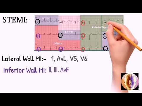 ECG/EKG: Step by Step Interpretation ||(how to read ECG)!!