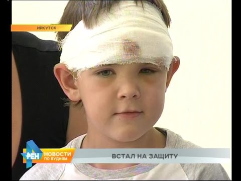7-летний герой. Юный иркутянин спас от напавшей собаки маленькую девочку, но сам получил травмы