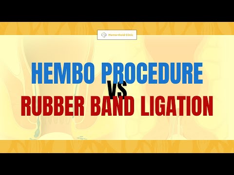 Difference between a Hembo procedure and a rubber band ligation?