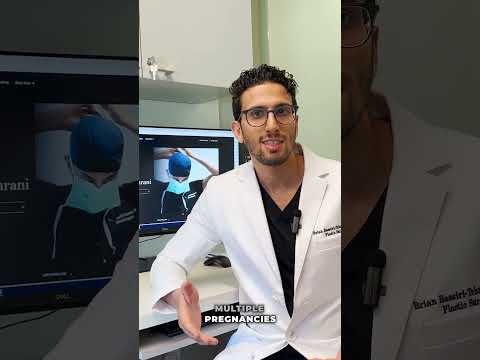 Diastasis recti explained with pictures #diastasisrectirepair #diastasis #nyc #plasticsurgeon