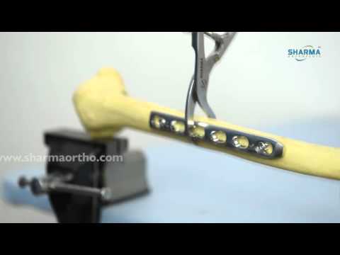 Dynamic Compression Locking Plate- DCP Narrow