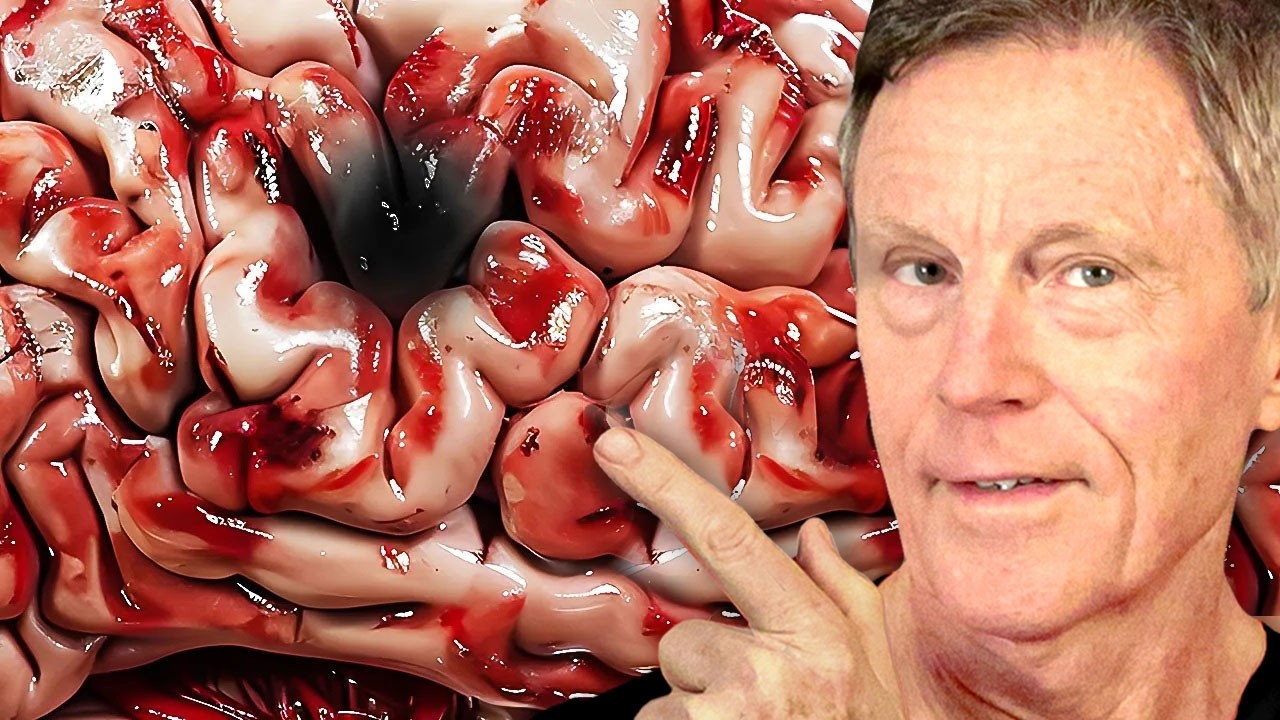 How I AVOIDED a Stroke: My Atrial Fibrillation Story