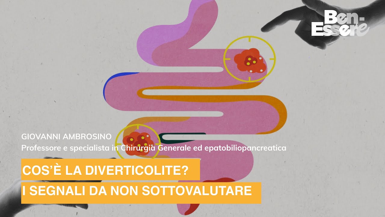 COS’È LA DIVERTICOLITE? I SEGNALI DA NON SOTTOVALUTARE