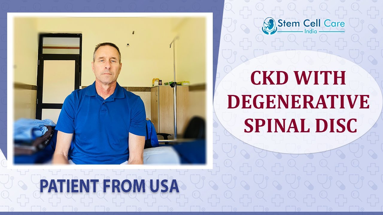 The Patient From the USA Shares His Experience After Stem Cell Therapy For CKD With Degenerative SD