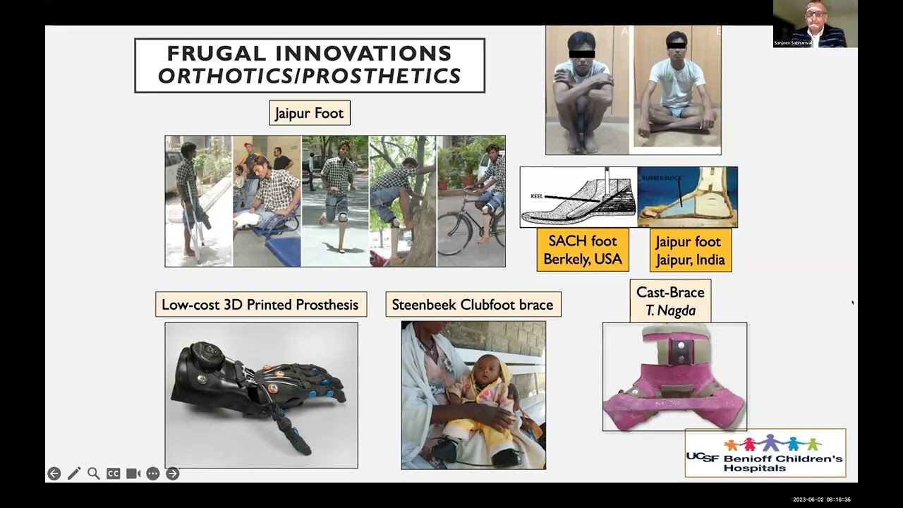 Session 04: Bidirectional Learning Missed Opportunities