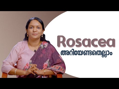 Rosacea: Causes & Management