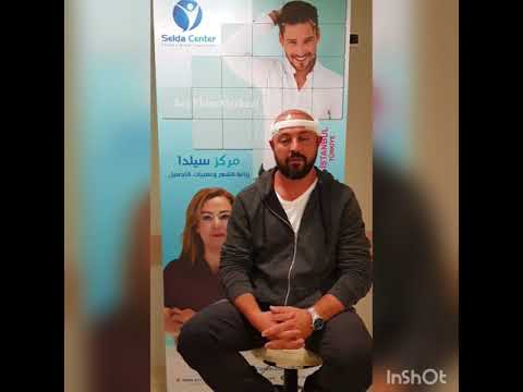 زراعة الشعر في تركيا اسطنبولseldacenter