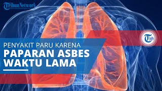 Asbestosis, Penyakit Paru karena Paparan terhadap Asbes dalam Kurun Waktu yang Lama