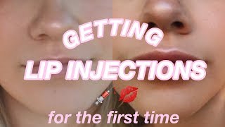 GETTING LIP INJECTIONS... The Truth about Lip Filler