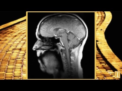 Click to Watch the 'If I Only Had a Brain': MRI technology gives an amazing inside look into a singing brain video