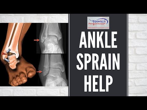 Lateral ankle sprain treatment & rehabilitation exercises video