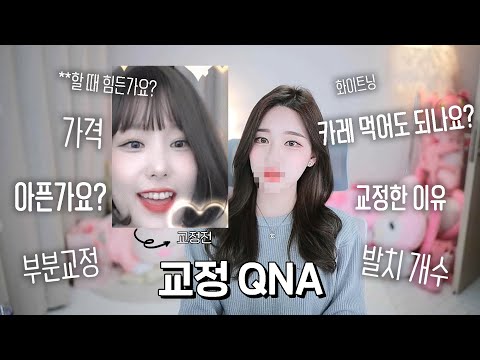 드디어 교정기 뻈습니다!????성형한거아님|교정 QNA|아프나요?|얼굴변화|발치|총비용|병원고르는팁