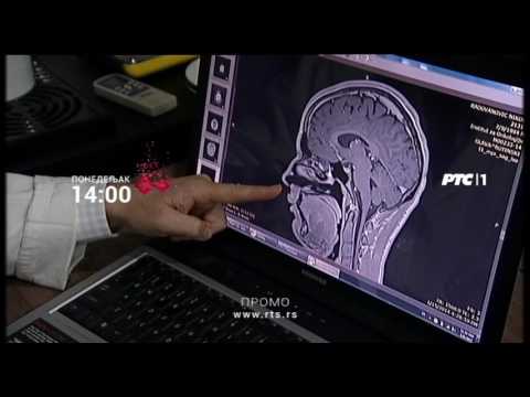 Profesionalci: Dr Dragan Savić - neurohirurg